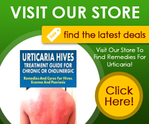 Urticaria Store